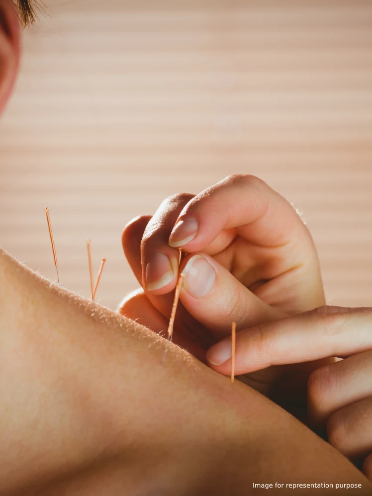 Precision Acupuncture Therapy at Yogtatvah Wellness & Beyond in Thane, Thane